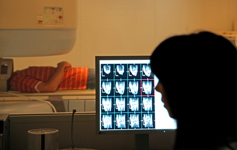 Studiu: Modurile ciudate prin care coronavirusul poate afecta creierul