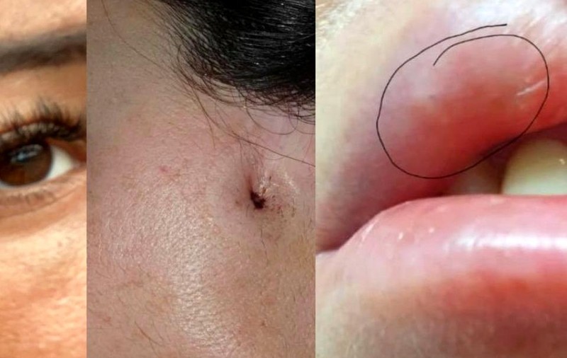 „Dr. Lana”, femeia acuzată că făcea operații estetice fără drept de practică, trimisă în judecată