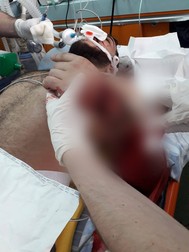 Interlopul Nicolae Victor este încadrat în gradul I de handicap grav cu însoțitor, având un picior amputat, iar celălalt picior și brațul stâng îi sunt grav afectate