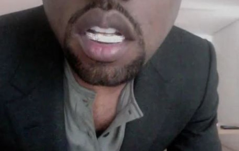 Rapperul Kanye West şi-a scos dinţii de jos şi i-a înlocuit cu diamante