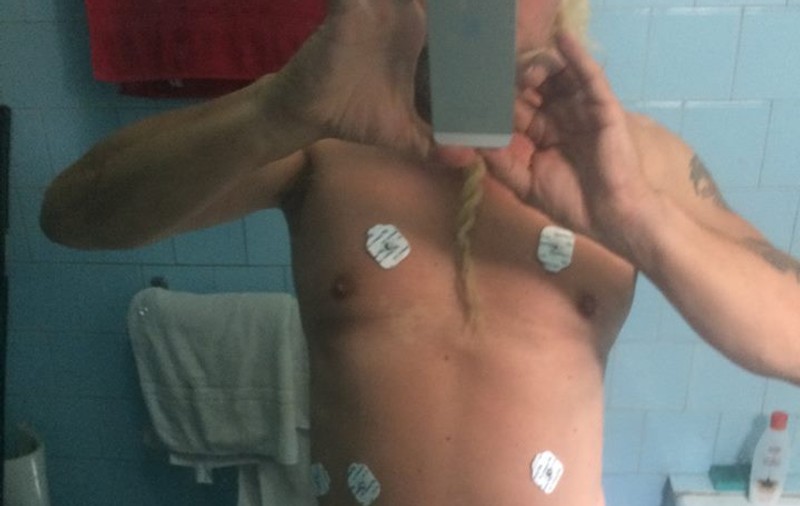EXCLUSIV. Rockerul Amedeo Bolohoi, salvat întâmplător, după ce a făcut infarct pe stradă