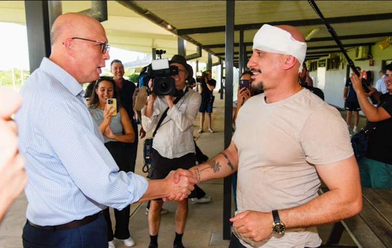 Liderul opoziției din Australia i-a spart capul unui cameraman, după ce l-a lovit din greșeală cu o minge de fotbal australian