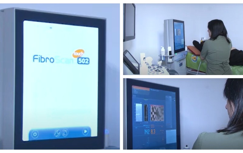 Investigații gratuite pentru ficat, la un spital din Timișoara, cu ajutorul unui dispozitiv Fibroscan  | VIDEO