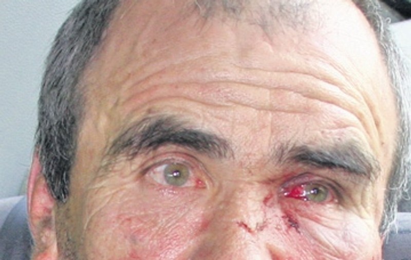 Un bărbat şi-a ucis fiica din... greşeală