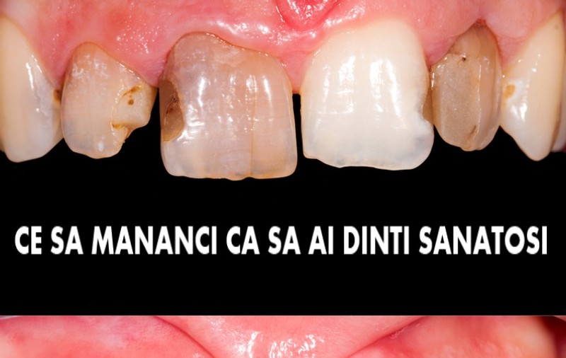 Ce să mănânci ca să ai dinți sănătoși