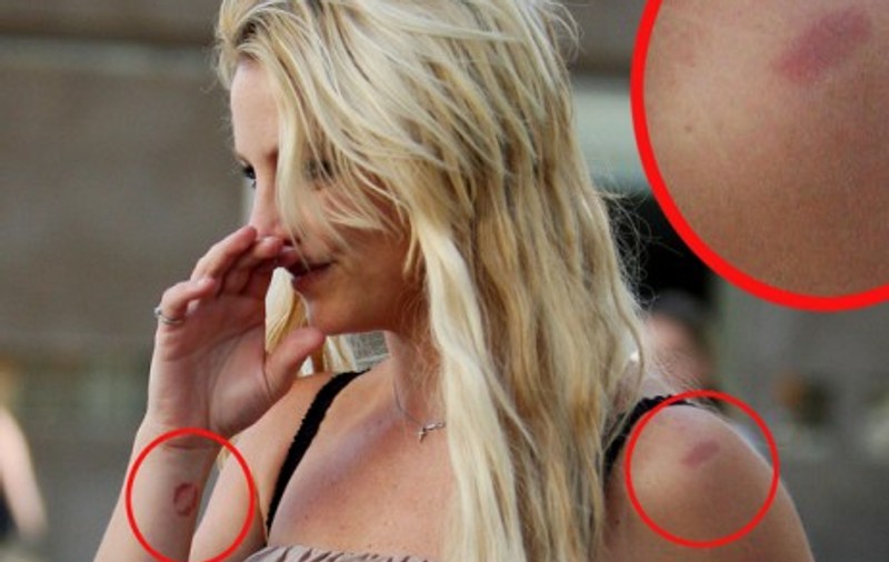 Britney Spears, mărturisire şocantă: "Iubitul meu m-a bătut!"