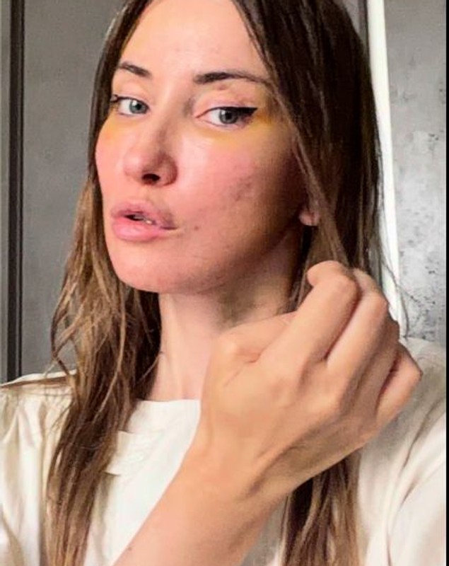 Iulia Albu, sinceră despre intervențiile estetice: „Mi-am dorit un deep plane facelift. Fără filtre, fără vrăjeală”