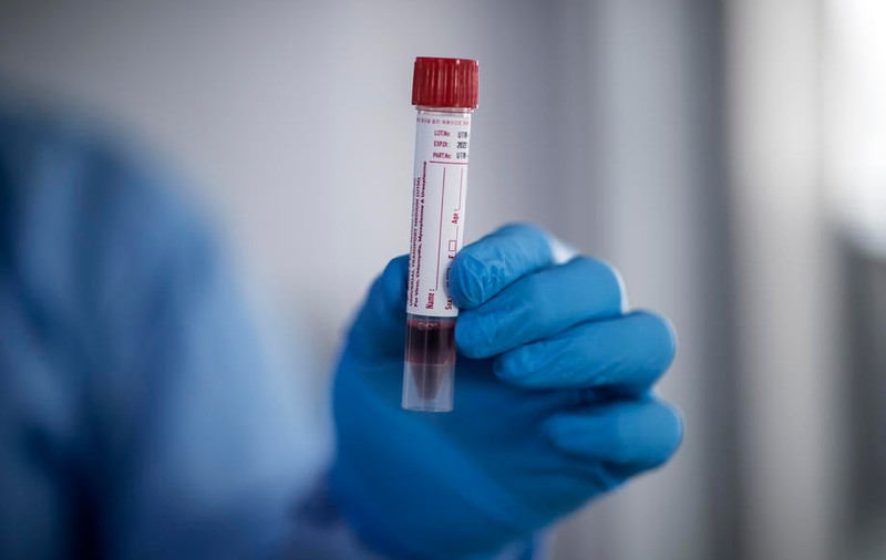 Primul județ care va începe testarea în masă a populației. Cine va avea prioritate