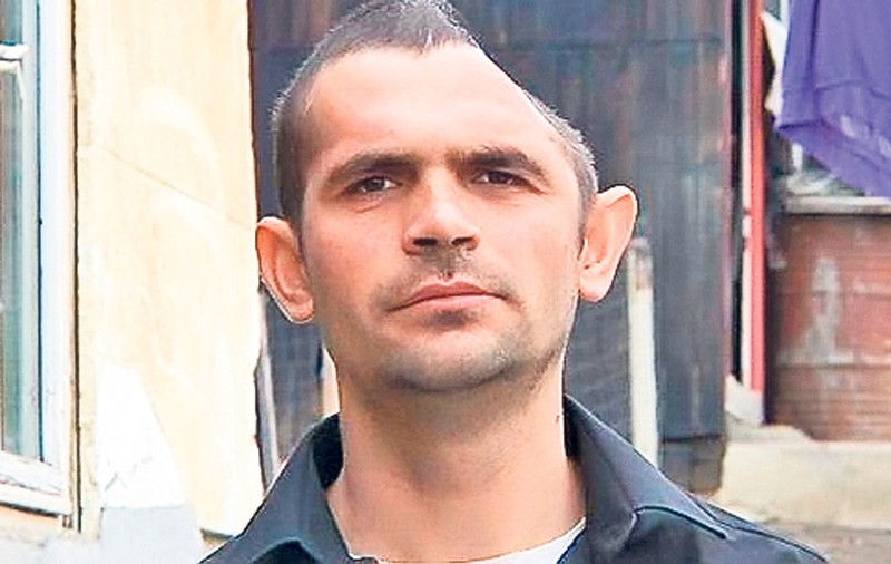A trăit 11 luni fără jumătate de craniu