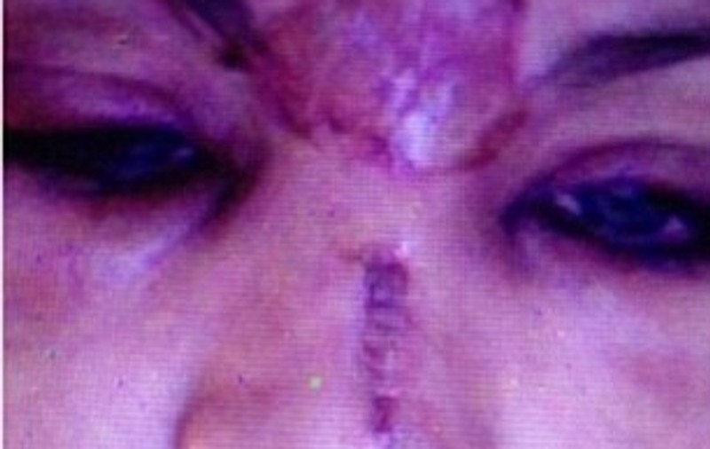 O vedetă si-a distrus faţa după un accident şi E FERICITĂ că a păţit-o! Vezi de ce!
