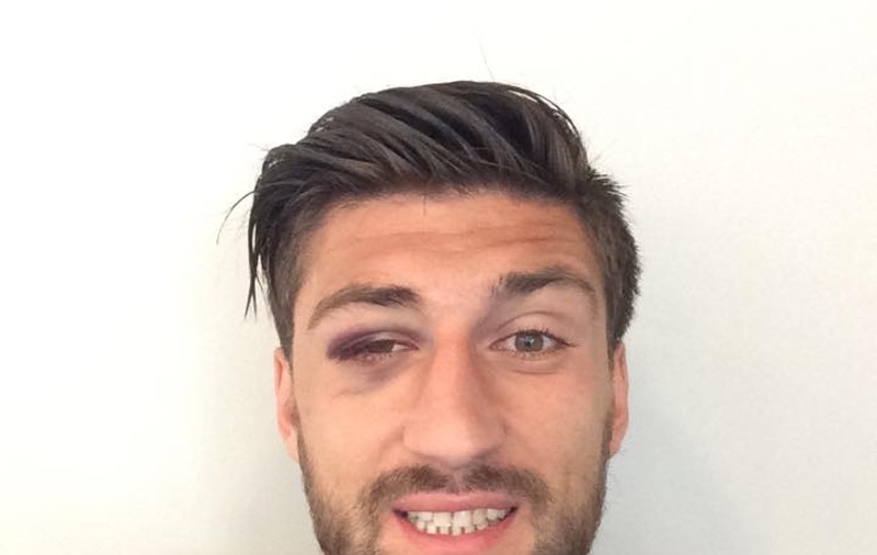 Paul Papp face haz de necaz pe seama accidentării suferite