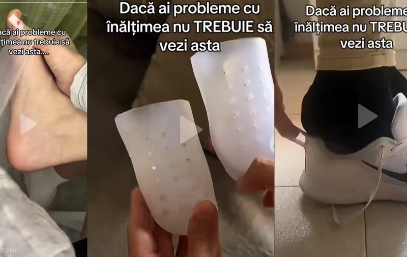 Ce riscuri de sănătate implică purtarea prelungită a tălpilor din silicon care „te fac mai înalt”. Radu Paraschiv, doctor ortopedie-traumatologie: „Pot genera tulburări de mers”
