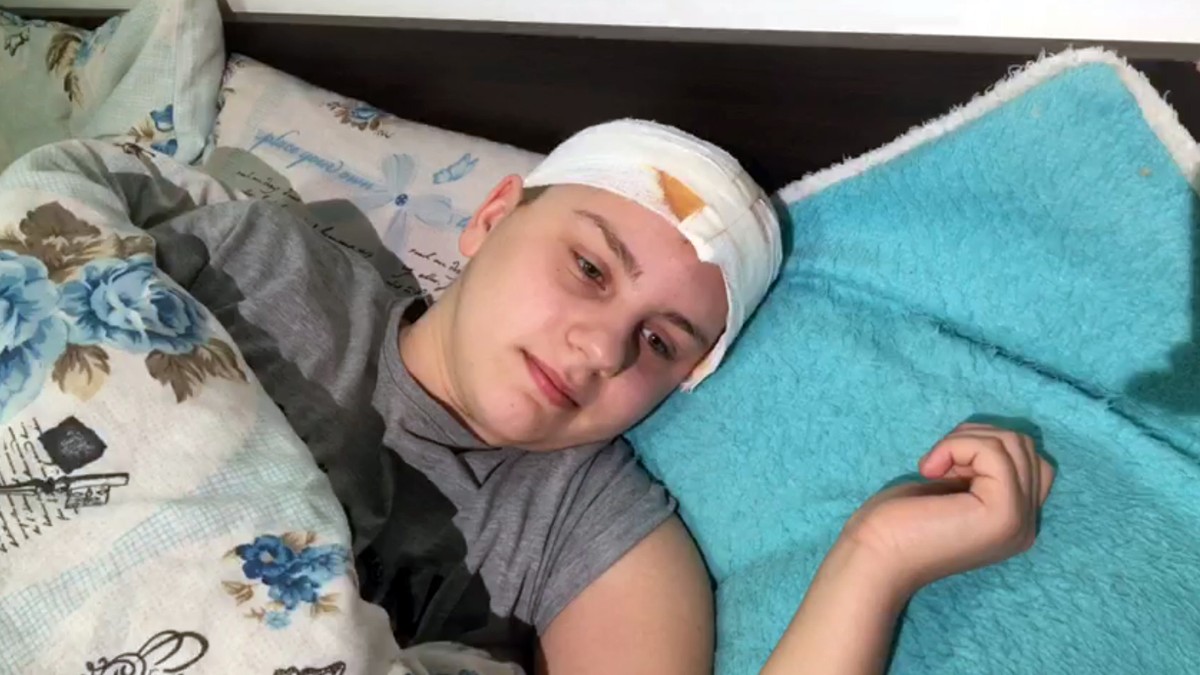 Un accident stupid o costă un an din viață. Alina, fata care a căzut cu tot cu geam dintr-un autobuz din Ploiești, a fost externată, dar e țintuită la pat