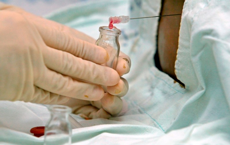Infecţiile banale pot duce la apariţia leucemiei