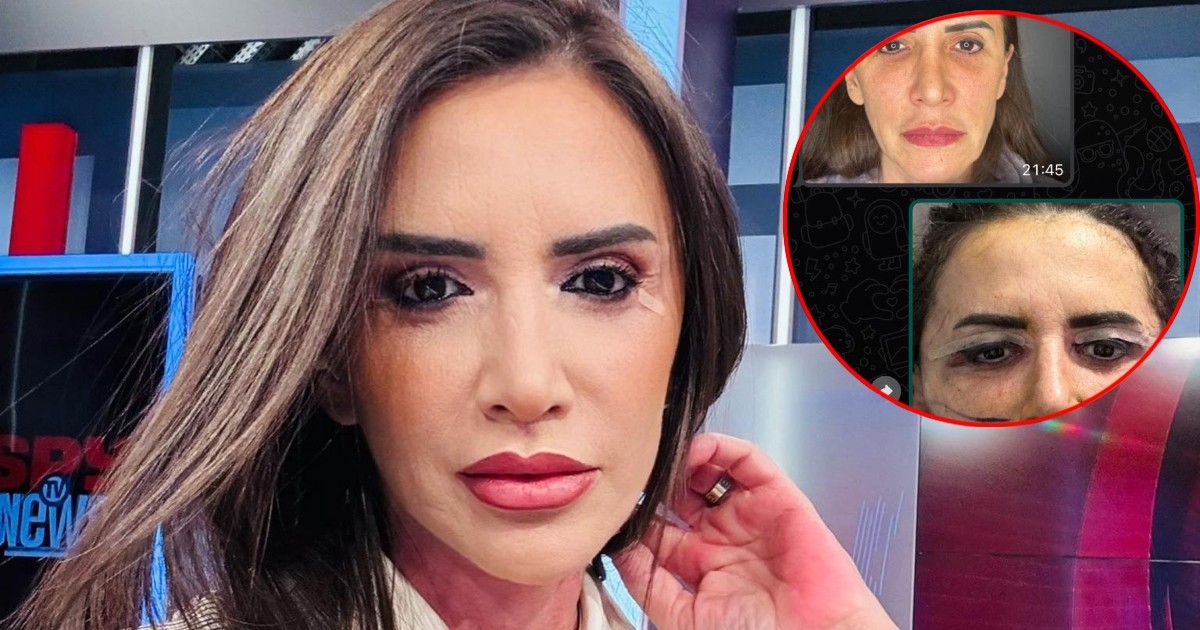Mara Bănică despre operațiile estetice