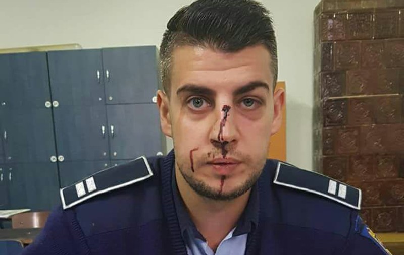 VIDEO EXCLUSIV | Un polițist din județul Dolj a fost bătut de un șofer beat