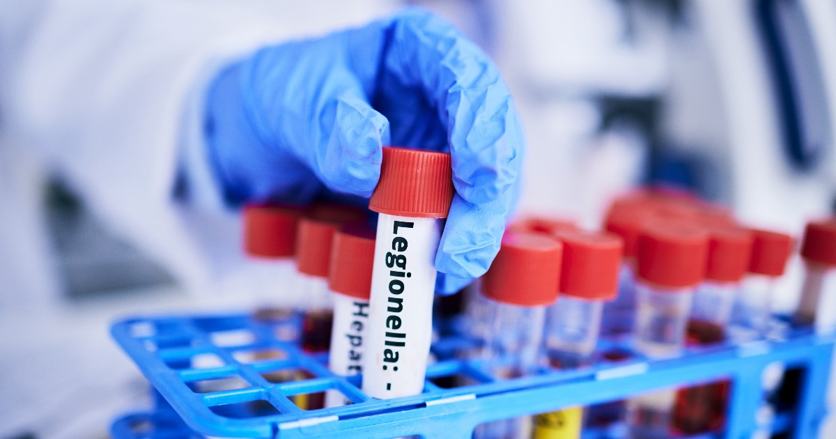 Imaginea prezintă o mână care poartă o mănușă de protecție și introduce o eprubetă etichetată „Legionella” într-un suport de laborator, alături de alte probe de sânge. Fotografia ilustrează activitatea de analiză și testare în laborator pentru depistarea bacteriei Legionella.
