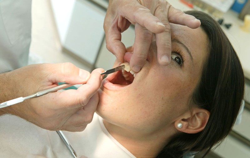 O româncă și-a dus o clientă la un fast-food din Londra, pentru a-i monta o punte dentară