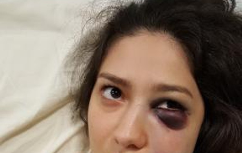 Tânără din Oradea, bătută pentru că a refuzat avansurile a doi bărbați. Unul dintre agresori e căsătorit