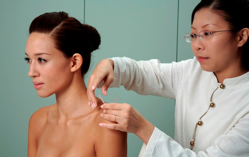 Acupunctura combate afecțiunile femeilor