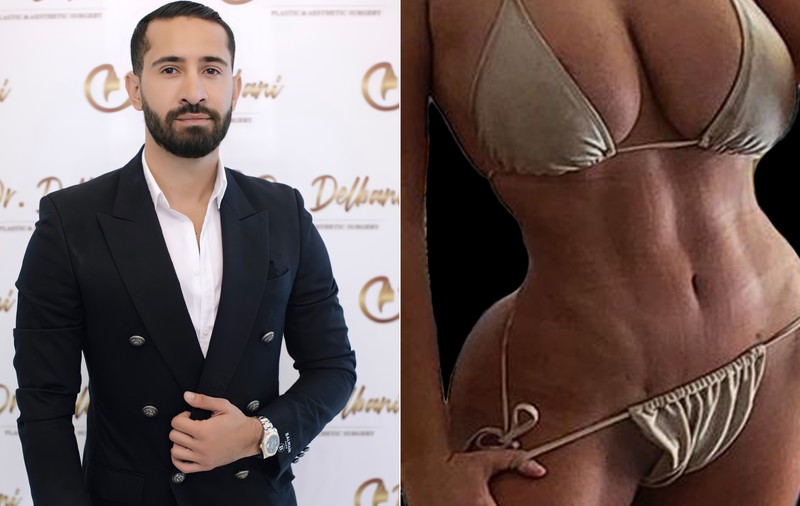 Cum să obții un abdomen ca în sala de sport. Transformarea corpului cu ajutorul liposucției abdominale Vaser HD by Dr. Delbani