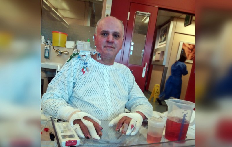 I-au tăiat două degete pompierului din Mehedinți ars în misiune, din cauza infecțiilor. Soția lui: „Dacă nu plecam pe cont propriu, Mihai rămânea fără o mână”