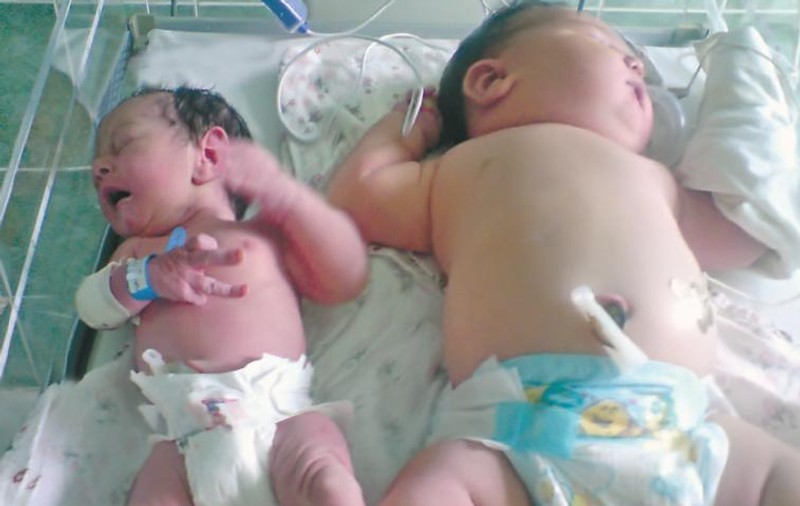 Mama bebeluşului gigant abia aşteaptă să-şi ţină fetiţa în braţe