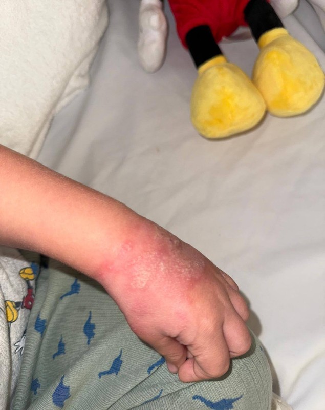 Un copil de doi ani a fost ținut patru zile cu branula neschimbată, la Spitalul de Urgenţă Râmnicu Vâlcea