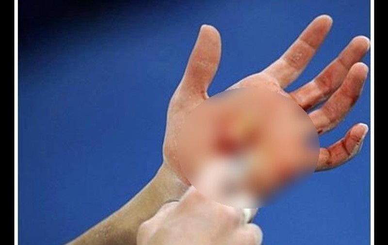 IMAGINE CUTREMURĂTOARE! Vezi ce SACRIFICII INCREDIBILE fac SPORTIVII DE PERFORMANŢĂ! FOTO