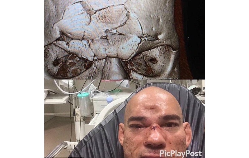 Imagini horror după o gală MMA la Londra. I-a rupt capul! | VIDEO