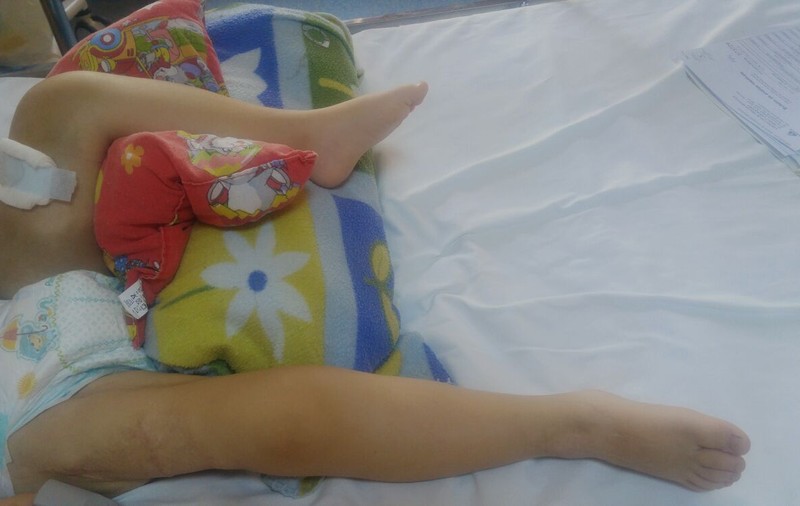 Copilul „cu picioarele necrozate” plimbat la trei spitale are o suferință congenitală. Medici: A fost internat frecvent