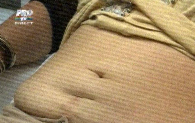 Minodora vrea să scape de burtă cu ajutorul bisturiului. Uite ce abdomen dizgrațios are!