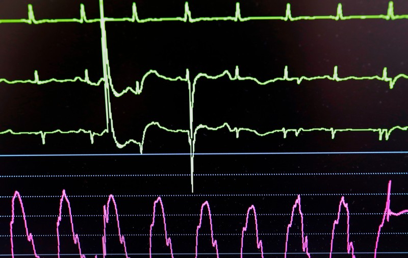 O femeie din Anglia a sunat la numărul de urgențe de pe patul de spital pentru că o asistentă a ignorat simptomele de pe monitorul cardiac