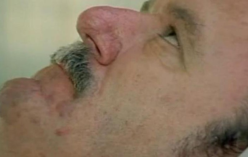 OMUL CARE ŞI-A PIERDUT TRUPUL. Nimeni nu înţelegea ce simte şi cum e posibil | VIDEO