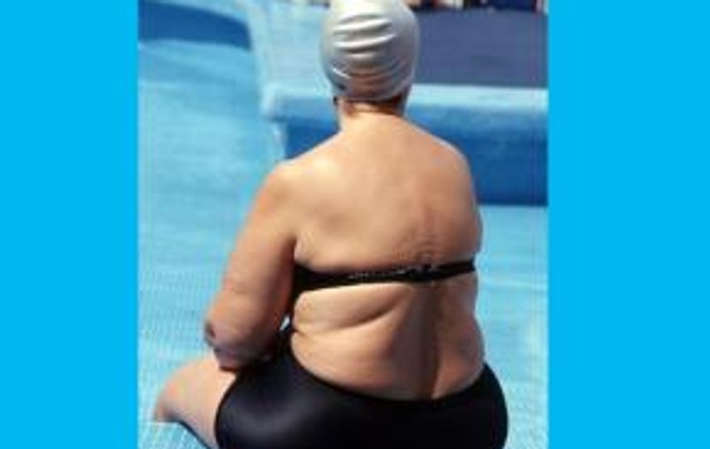 Obezitatea îi costă pe americani 147 miliarde de dolari pe an