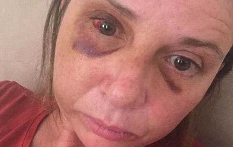 Cuvintele sfâșietoare spuse de un copil de trei ani după ce și-a văzut mama bătută crunt de tatăl lui