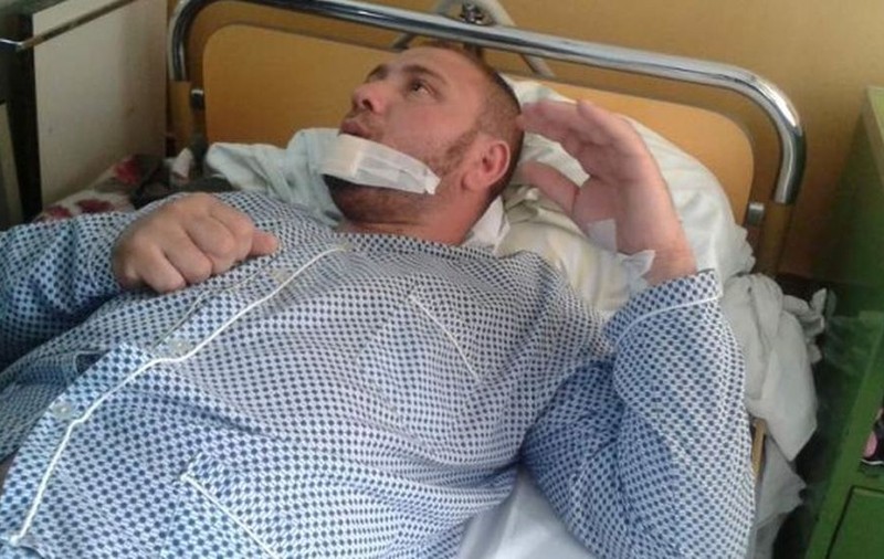 A rămas fără buza de jos după ce a fost muşcat de un alt bărbat 