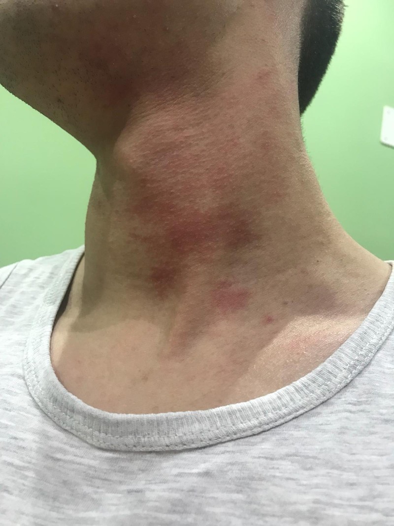 Foto