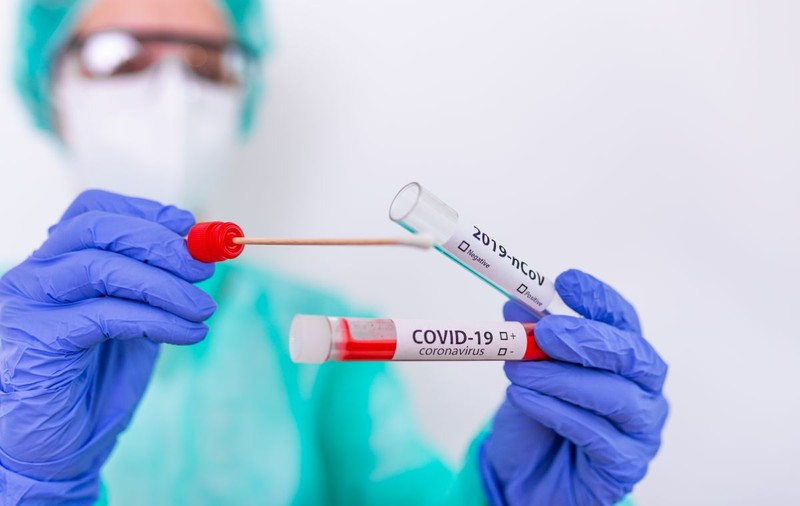 Turcii au dezvoltat un nou test COVID-19, care oferă rezultatul în doar zece secunde
