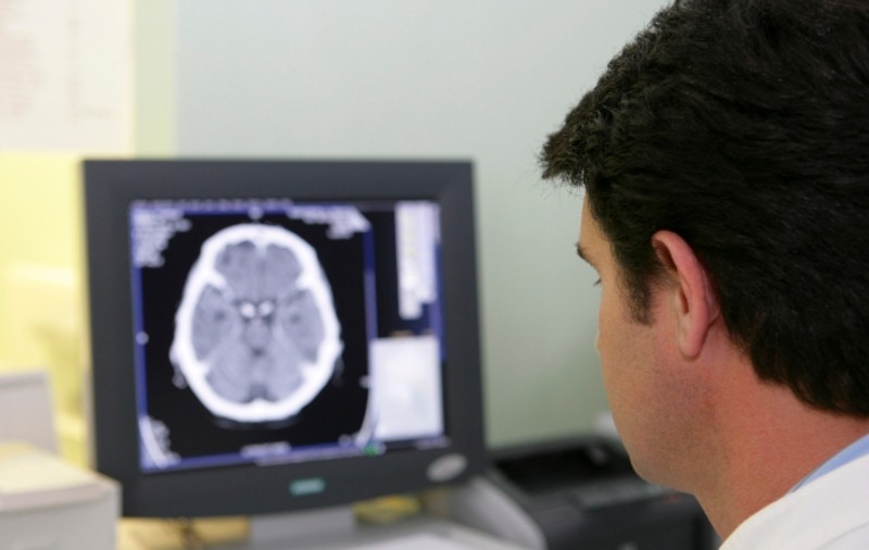 Geniul care uimeşte o lume întreagă! La 21 de ani e medic neurolog