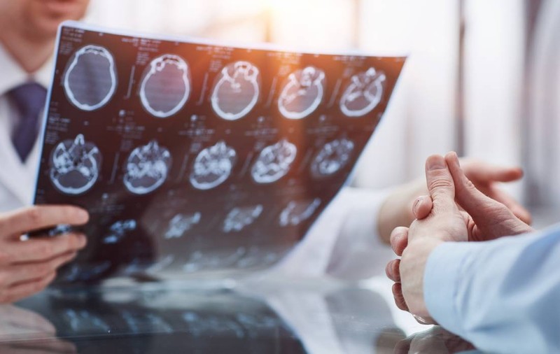 Ipoteză revoluționară: Alzheimerul ar putea fi declanșat de infecții virale