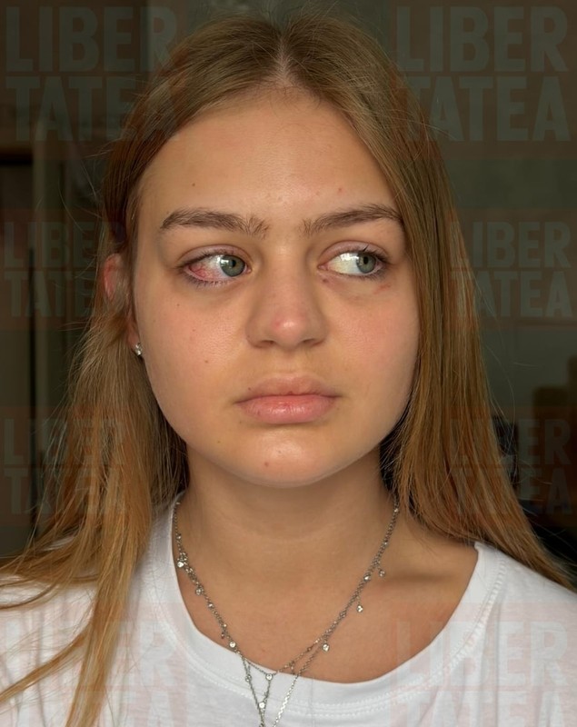 Ana Beregoi, primele declarații după scandalul cu Andreea Bostănică: „A sărit la mine și a început să mă lovească”. Cum a reacționat Iuliana Beregoi