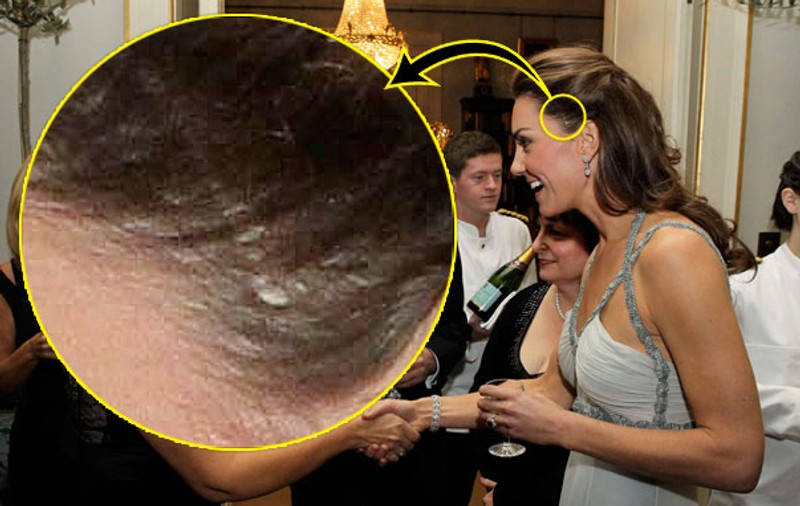 Foto | Imaginea care a şocat Marea Britanie şi a făcut presa să strige "Ce-a păţit Kate Middleton la cap?"