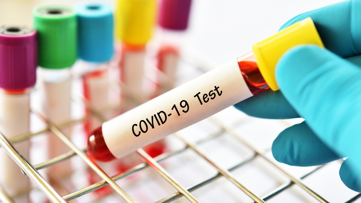 Test pentru depistarea COVID-19