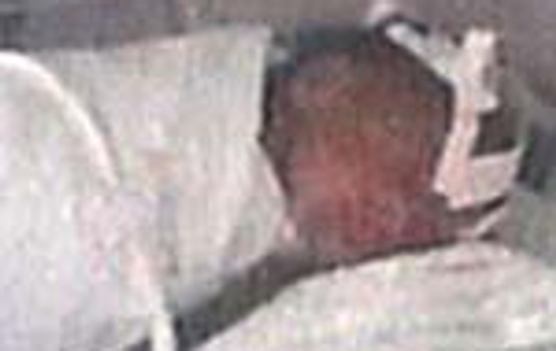 O fata de 14 ani, victima a proxenetilor, a nascut tripleti 