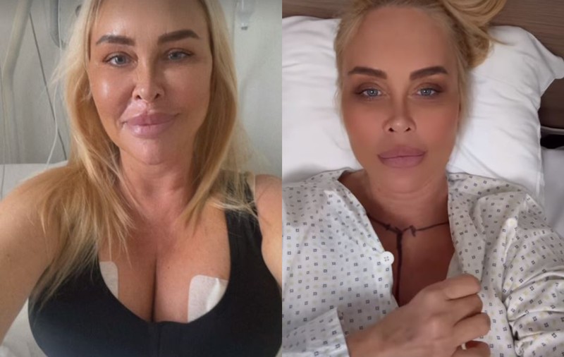 Vica Blochina, 6 ore pe masa de operație. Ce intervenții estetice și-a făcut: „Va fi nevoită să poarte un corset timp de aproximativ 8 săptămâni”