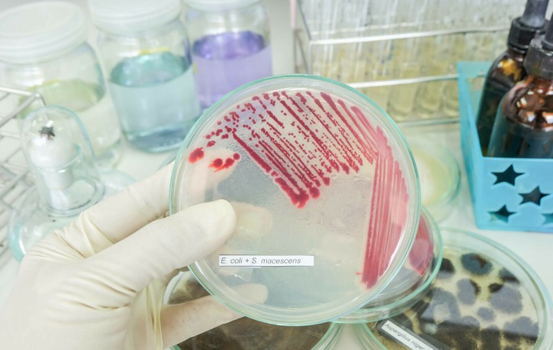 (P) Infecțiile spitalicești nu trebuie să mai ucidă: apel pentru implementarea tehnologiilor moderne în România