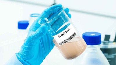 Apă cu E.coli în Târgu Secuiesc: DSP Covasna confirmă bacterii periculoase în fântânile din oraș, ce interzice legea