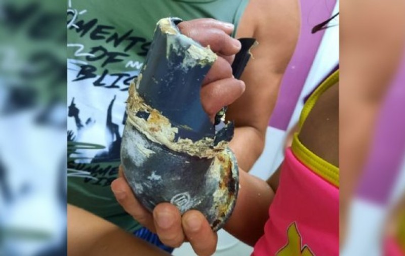 O fetiță de 5 ani, la spital, după ce și-a prins mâna în scurgerea unei piscine din Mamaia