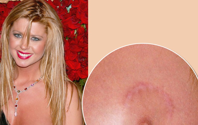 Înainte şi după silicoane: Tara Reid
